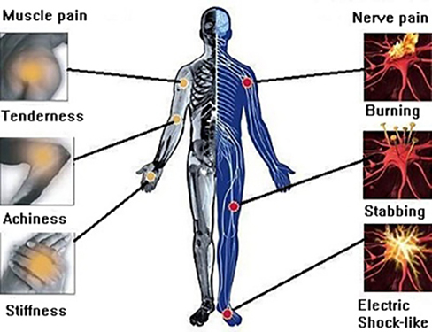 AFFLICTION REGIONS FOR TREATMENT