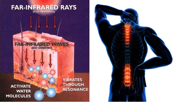 Infrared for Back Pain