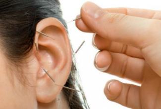 Acupuncture Points of Ear Region