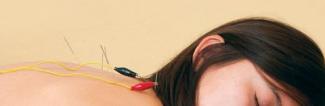 Electro-acupuncture