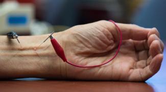 ELECTRO-ACUPUNCTURE WRIST